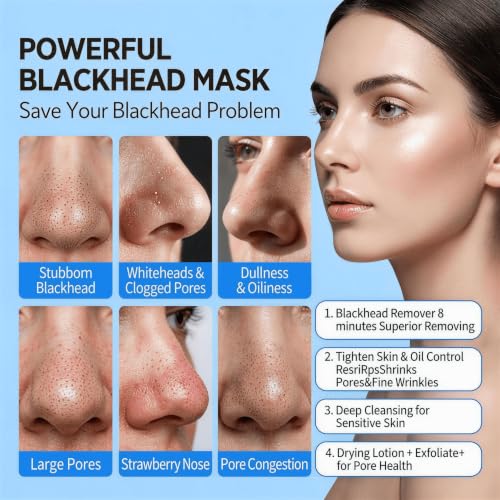 Blackhead Remover & Pore Minimizer Clay Mask, 3.53 oz - Product Imagery