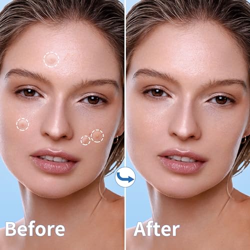 Daolyo Pimple Patches for Face, 4 Size 300 Counts Hydrocolloid - Product Imagery