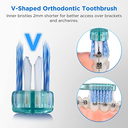Fregum V-Shaped Orthodontic Toothbrush for Braces with - Product Imagery