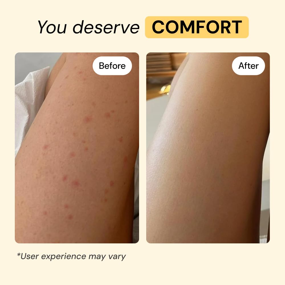 MyMagicHealer Thyme Tea Tree Flare Care - MyMagicHealer Official Imagery - 5