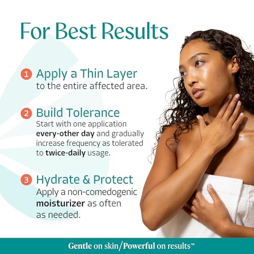 Almond Clear Mandelic Acid Level 2 Serum – Extra Strength - Product Imagery