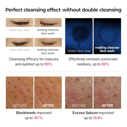 n Melting Bubble Foaming Cleanser - Micellar Makeup Remover Face - Product Imagery