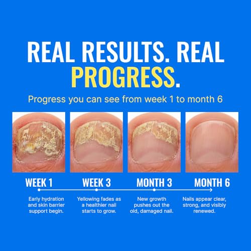 Approved Science Fungix Extra Strength - Undecylenic Acid and - Product Imagery
