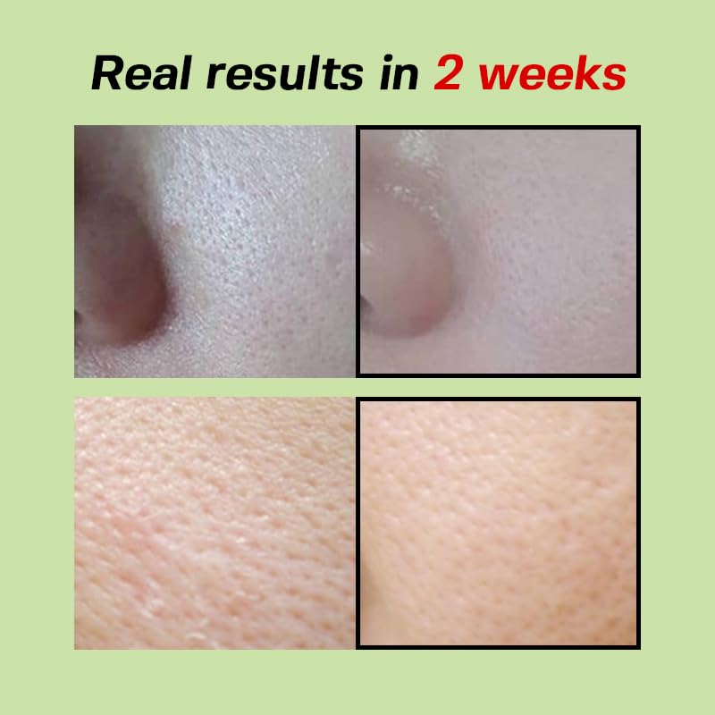 SUNGBOON EDITOR Green Tomato Pore Lifting Ampoule, Niacinamide, - Product Imagery