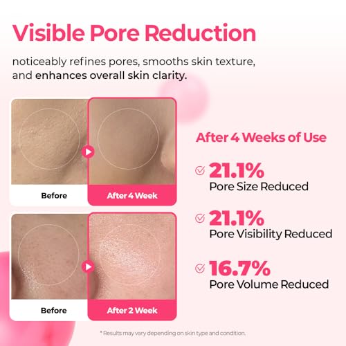 n Cyano Pink Spicule Serum with Vitamin B12, Liquid Microneedle - Product Imagery