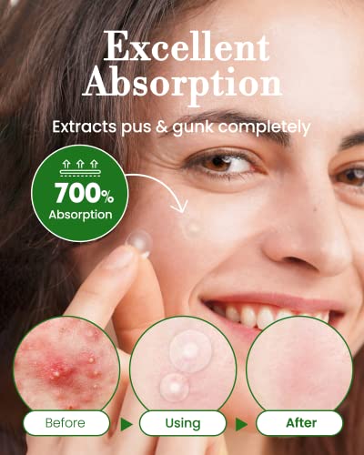 Troubless Invisible Pimple Spot Patch - 96 Ultra Thin Acne - Product Imagery