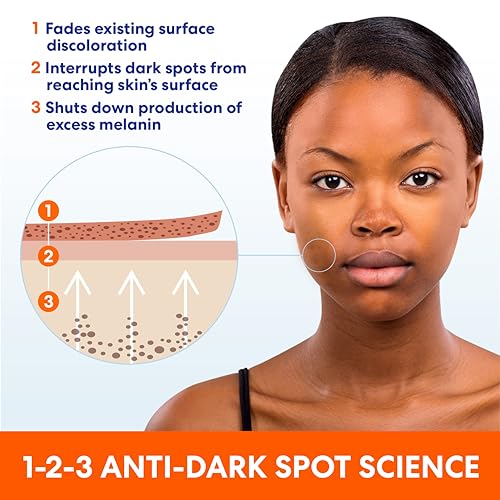 Palmer's Anti Dark Spot Face Cream with Vitamin E & Niacinamide - Product Imagery