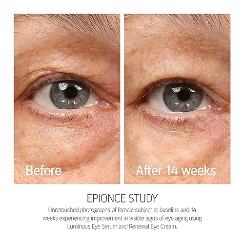 Epionce Renewal Eye Cream Anti-Aging Under Eye Cream Dark - Product Imagery