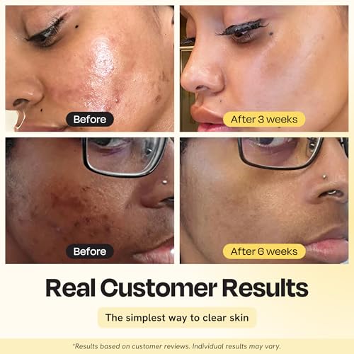 Gleamin Vitamin C Clay Mask for Dark Spots 2.5oz Brightening - Product Imagery