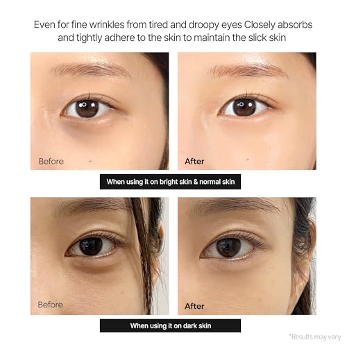 n Calcium Dark Spot Eye Cream 15g – Niacinamide & Calcium - Product Imagery