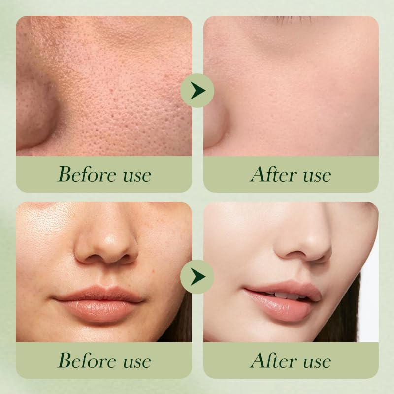 Avocado Skincare Sets, 6Pcs Skincare Gift Set with Facial - Product Imagery