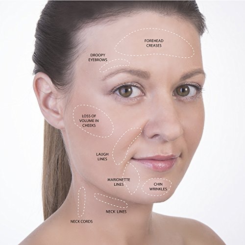 Face Cupping Set - Cupping Therapy Sets - Facial Cupping System - Product Imagery