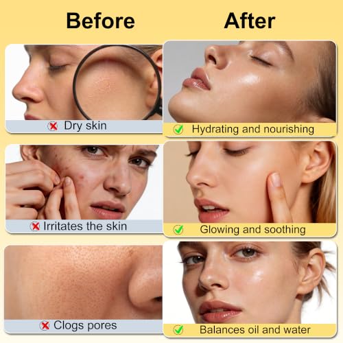 Skin Care Set w/Korean Rice Extract for Hydration,Glow,Repair - Product Imagery