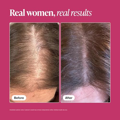 Viviscal Hair Growth Supplements for Women, 180 Tablets, 90-Day - Product Imagery