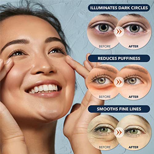Purederm Collagen Eye Patches for Puffy Eyes, Dark Circles & - Product Imagery
