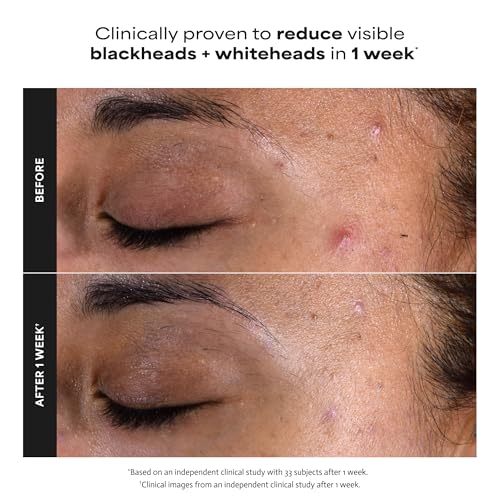Paula's Choice SKIN PERFECTING 2% BHA Liquid Exfoliant - Product Imagery