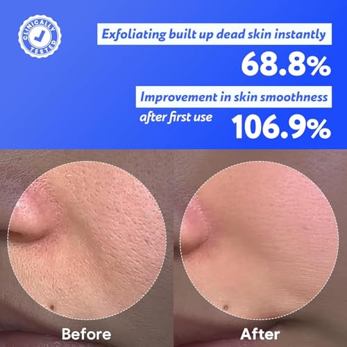 Coconut Jelly Pudding Cleanser | Deep Pore Cleansing & Gentle - Product Imagery
