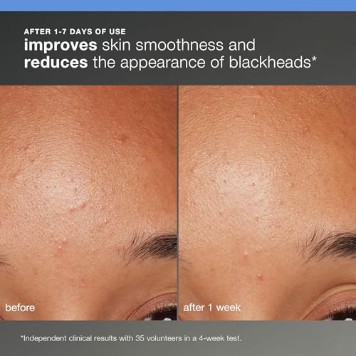 Dermalogica Discover Healthy Skin Kit, 4 Piece Travel Skincare - Product Imagery