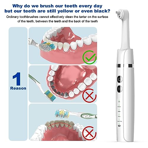 Tooth Polisher,Teeth Polishing Kit for Daily Cleaning,Polishing - Product Imagery