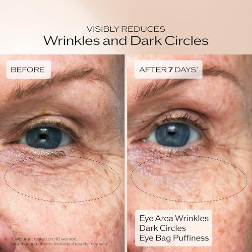 Shiseido Benefiance Wrinkle Smoothing Eye Cream - 15 mL - - Product Imagery