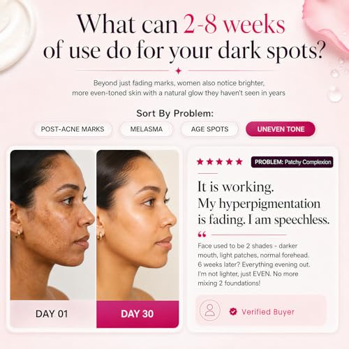 Korean Brightening Cream for Face & Body, Arbutin And Tranexamic - Product Imagery