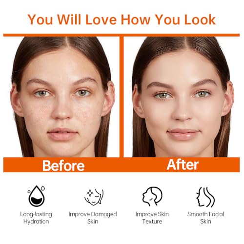 Vitamin C & Niacinamide Skincare Set, 6-Piece Face Care Kit with - Product Imagery