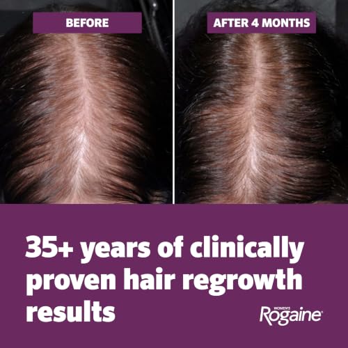 Women's Rogaine Hair Growth Foam, 5% Topical Minoxidil, 4 Mo, 2x - Product Imagery