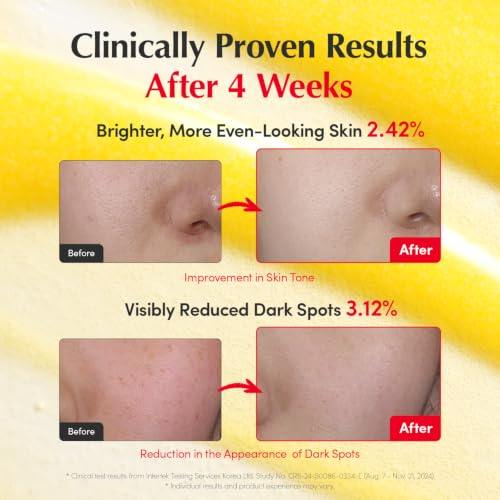 EQQUALBERRY Vitamin Illuminating Serum Triple Pack | Niacinamide - Product Imagery