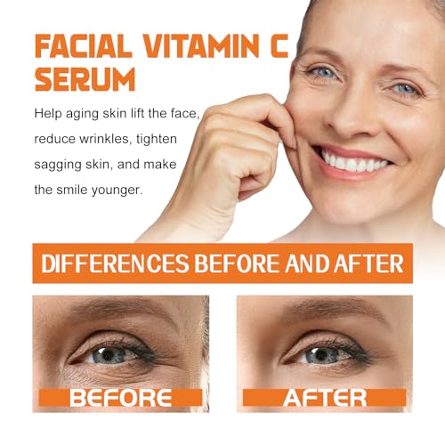 Facial Vitamin C Serum, 30ml, Firming & Lifting, Fades Dark - Product Imagery