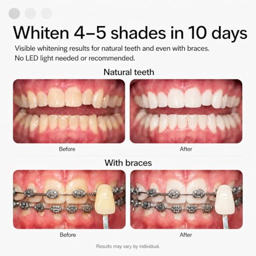Opalescence GO 15 Mint Whitening Bundle (7 Treatments) & - Product Imagery