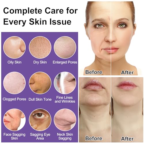 Skin Care Set,6Pcs Tighten, Lift, Firm, Hydrate & Radiant Facial - Product Imagery