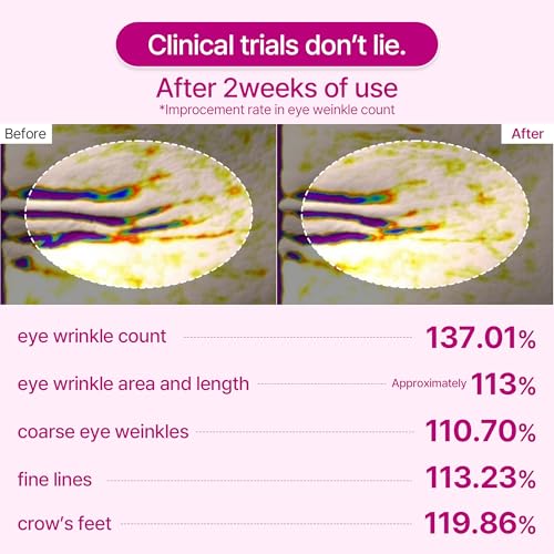 n Calcium Volume Under Eye Patches for Puffy Eyes & Dark - Product Imagery