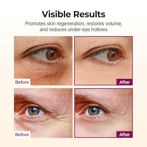 n Collagen Multi Balm Stick, Calcium & Adenosine Korean Wrinkle - Product Imagery