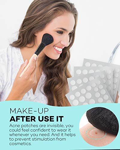 TKTK Pimple Patch for Face, Hydrocolloid Acne Absorbing Dots, 4 - Product Imagery