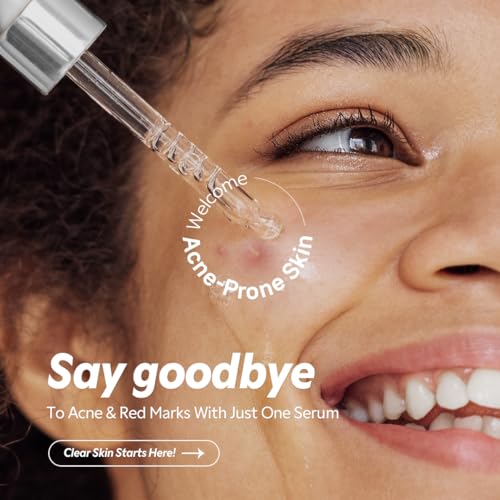 TIRTIR Azelaic Acid 12% Serum for Blemish-Prone Skin - - Product Imagery