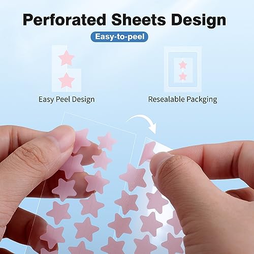 QUSTERE Pimple Patches for Face, Hydrocolloid Acne Patches, Cute - Product Imagery