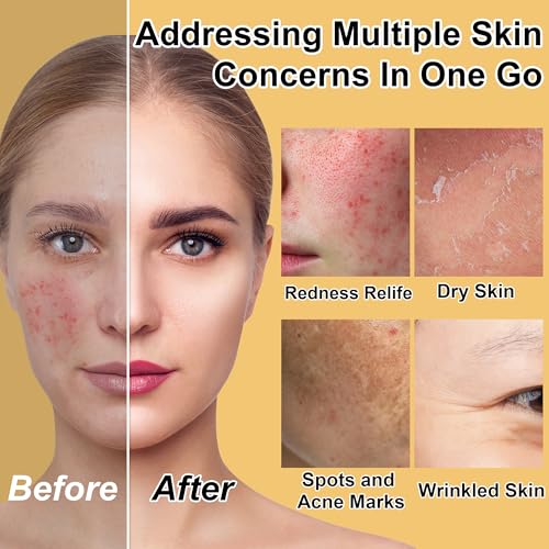 Skin Care Set for Teens Womens,Anti-Aging Deeply Hydrates - Product Imagery