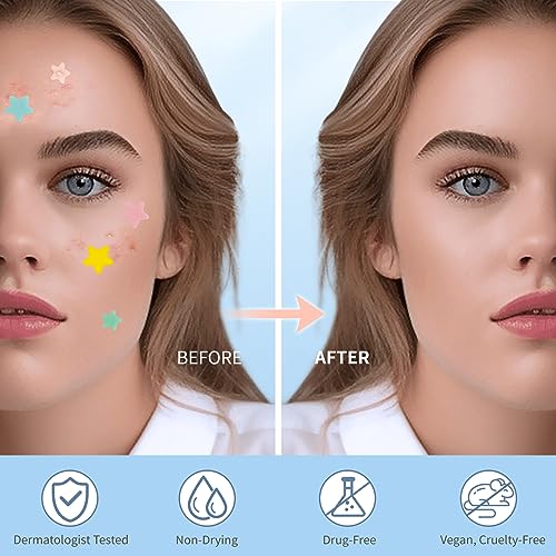 QUSTERE Pimple Patches for Face, Hydrocolloid Acne Patches, Cute - Product Imagery