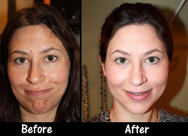 Azzy’s 20% Jessner Chemical Peel - Maximum Professional Strength - Product Imagery