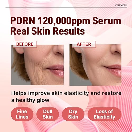 Salmon DNA PDRN 120,000 ppm EGF Peptide Microneedling Serum - Product Imagery