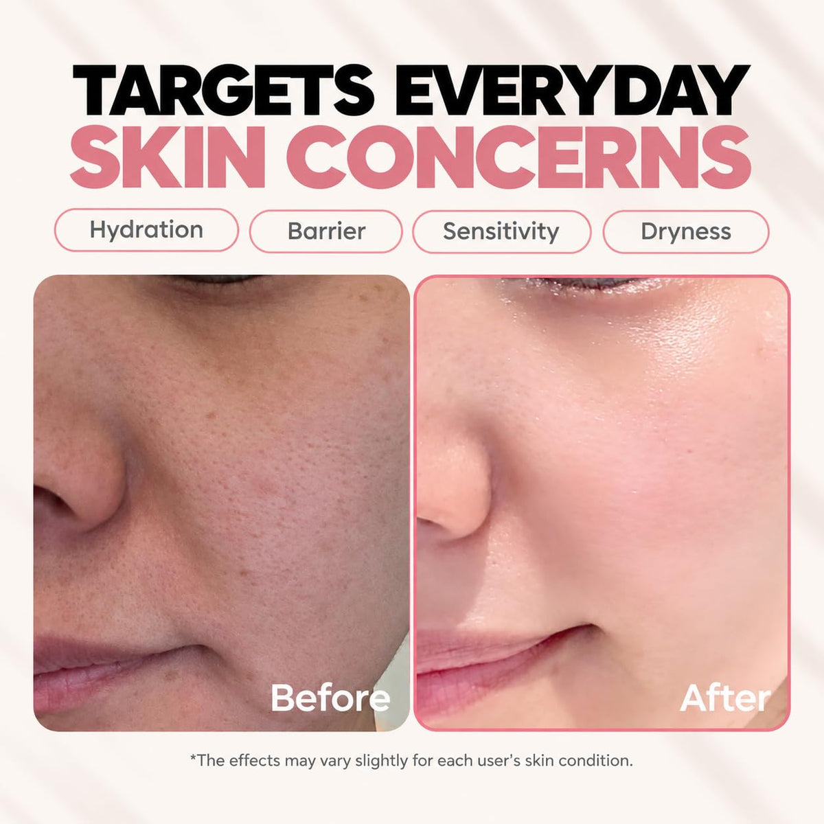 SFROMS Ceramide, Ectoin & Hyaluronic Acid Lotion for Dry & Sensitive Skin, Barrier Repair Moisturizer, Fragrance-Free, D
