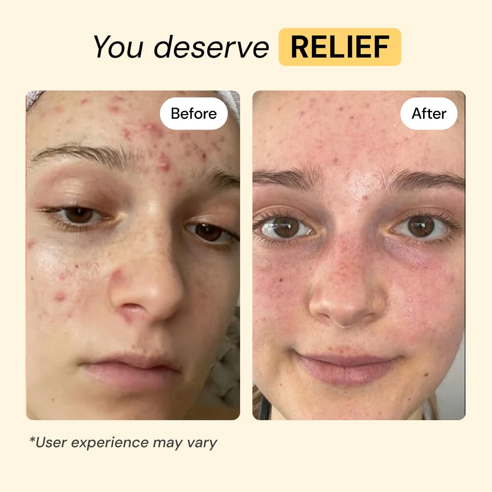 MyMagicHealer Thyme Tea Tree Flare Care - MyMagicHealer Official Imagery - 4