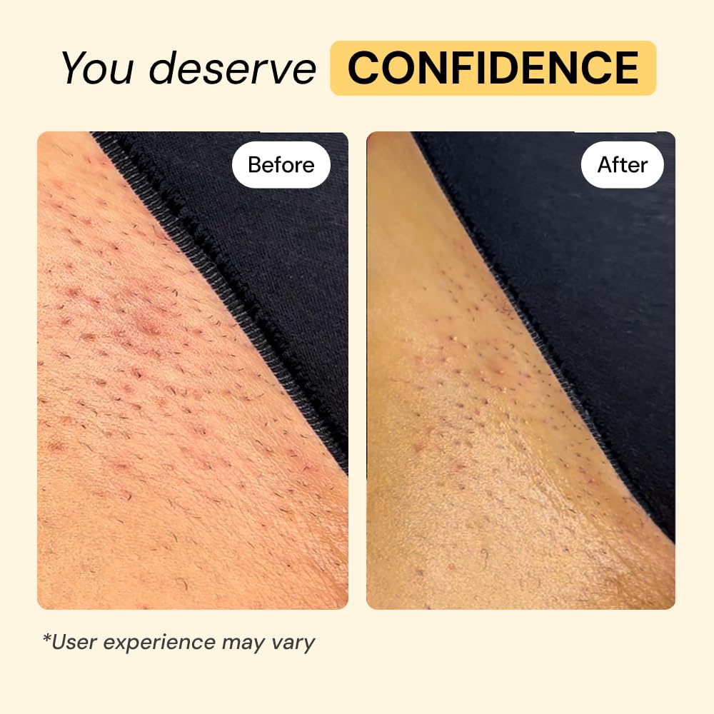 MyMagicHealer Thyme Tea Tree Flare Care - MyMagicHealer Official Imagery - 6