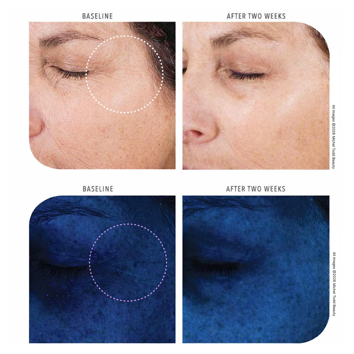 MICHAEL TODD Beauty KNU Cream - Face Lifting, Brightening & Tightening – back view and specifications
