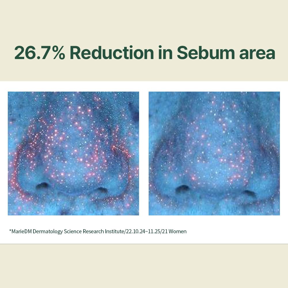 Pyunkang Yul calming moisture serum with Centella Asiatica, tea tree, hyaluronic acids, and ceramide for skin hydration and soothing care.
