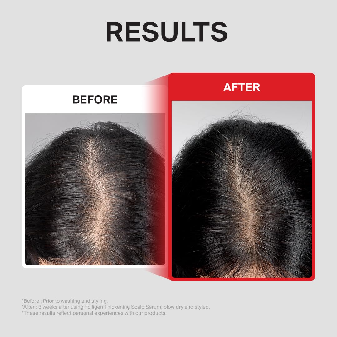 Dr.FORHAIR Folligen Thickening Scalp Serum 1.7 fl oz – back view and specifications