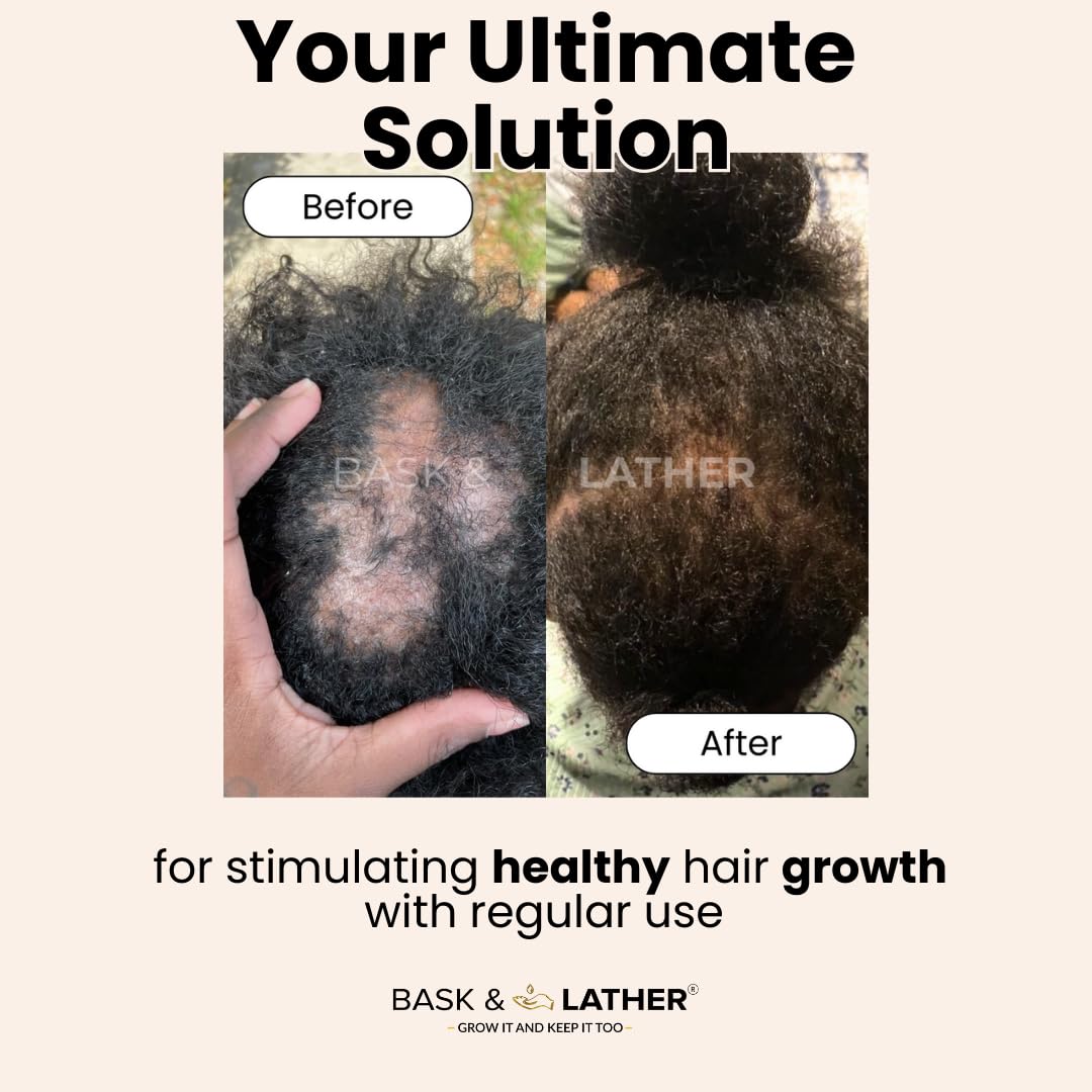 Bask & Lather scalp stimulator hair growth oil bottle with dropper, 4 fl oz, for promoting hair regrowth and scalp health.