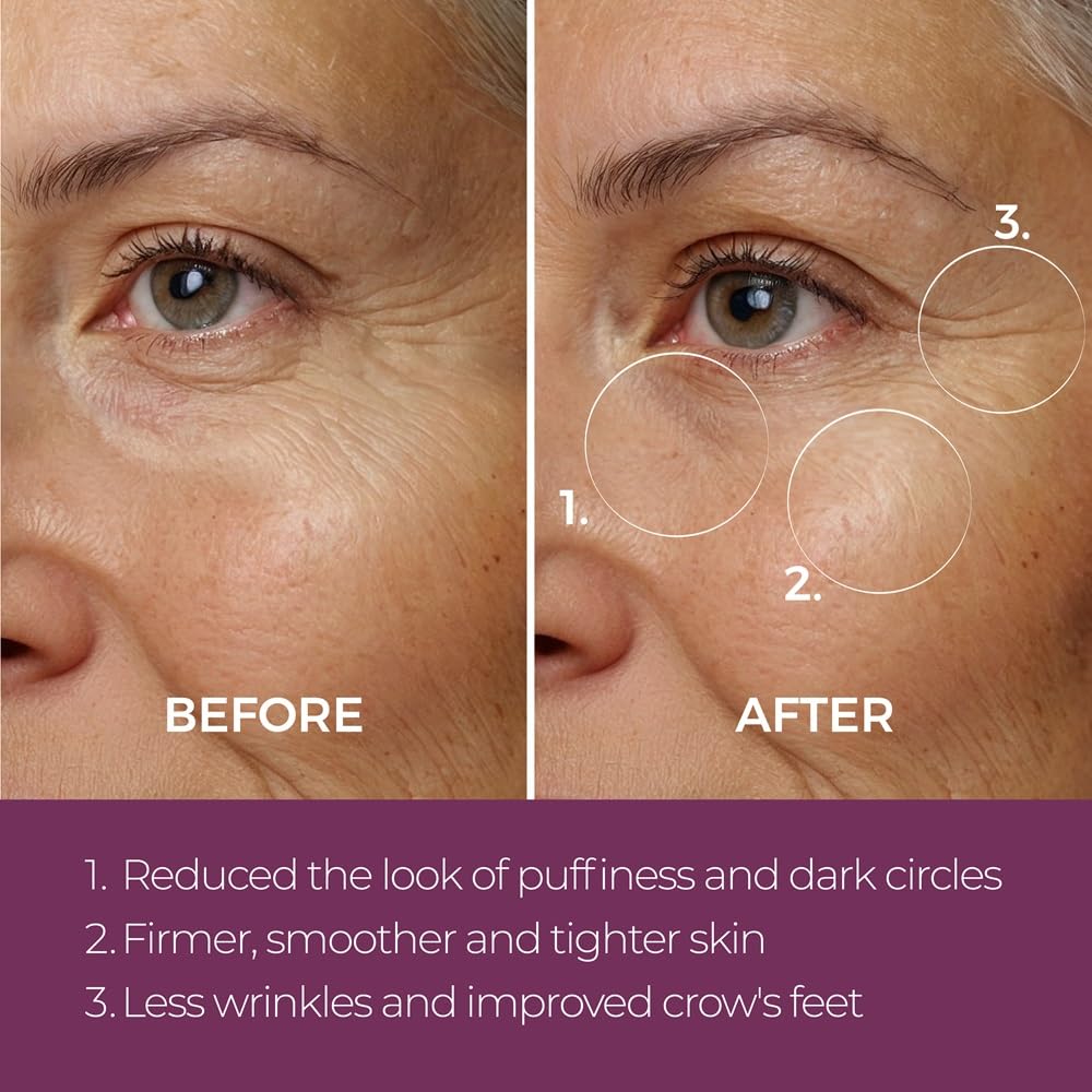 Blinc Eye Repair Peptide Complex eye cream in 0.5 oz jar, showing the sleek packaging and creamy texture for eye rejuvenation.