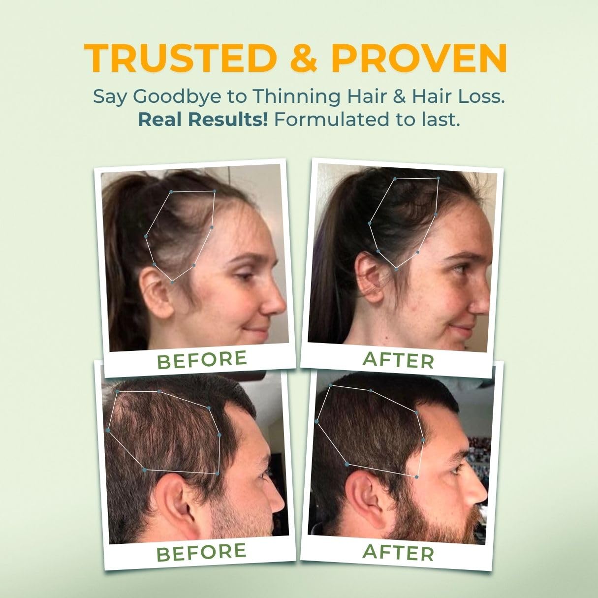 VITAL NUTRITIVE Biotin Hair Growth Vitamins - Hair, Skin & Nails Supplement