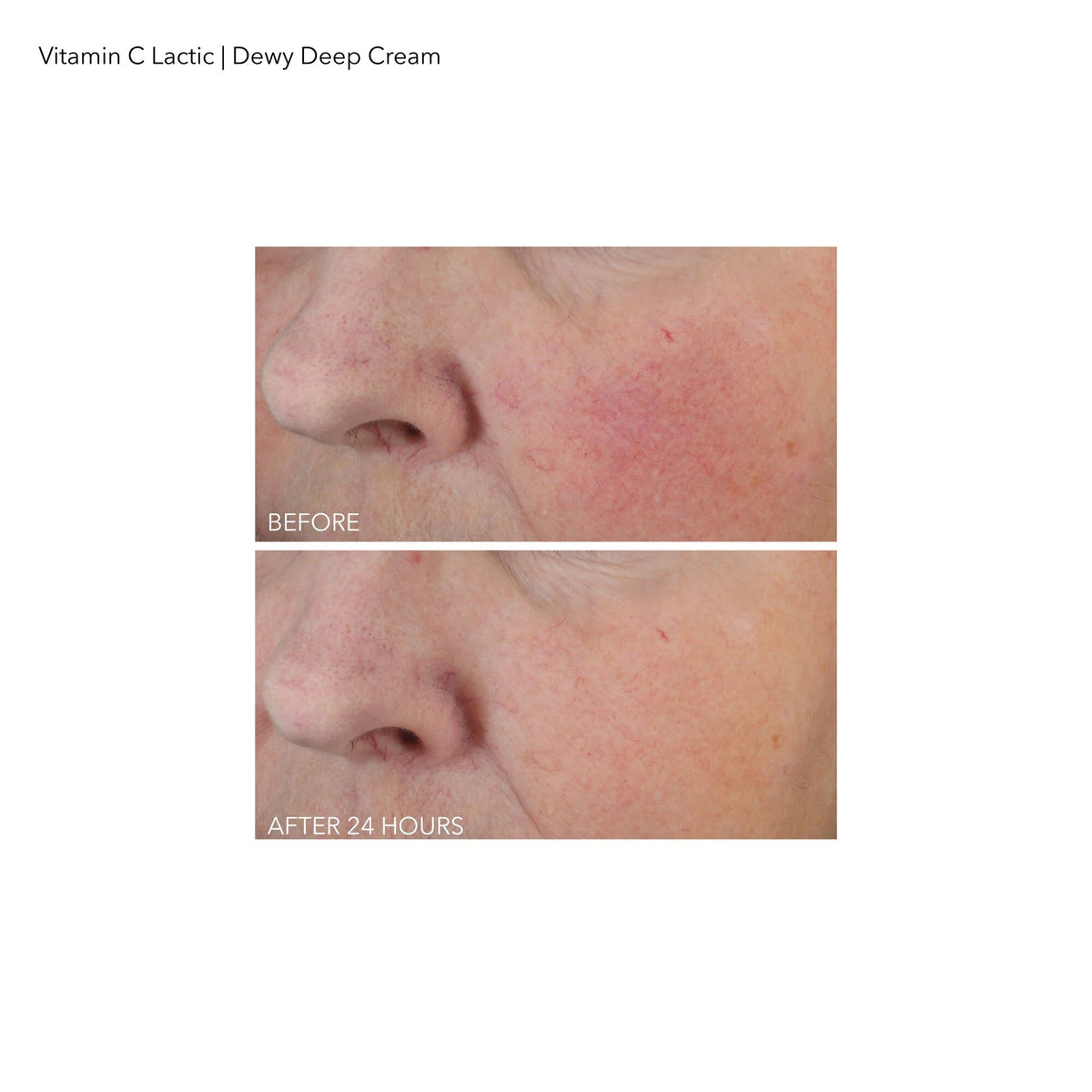 Dr Dennis Gross Vitamin C Lactic Dewy Deep Cream - Dr Dennis Gross Official Imagery - 8